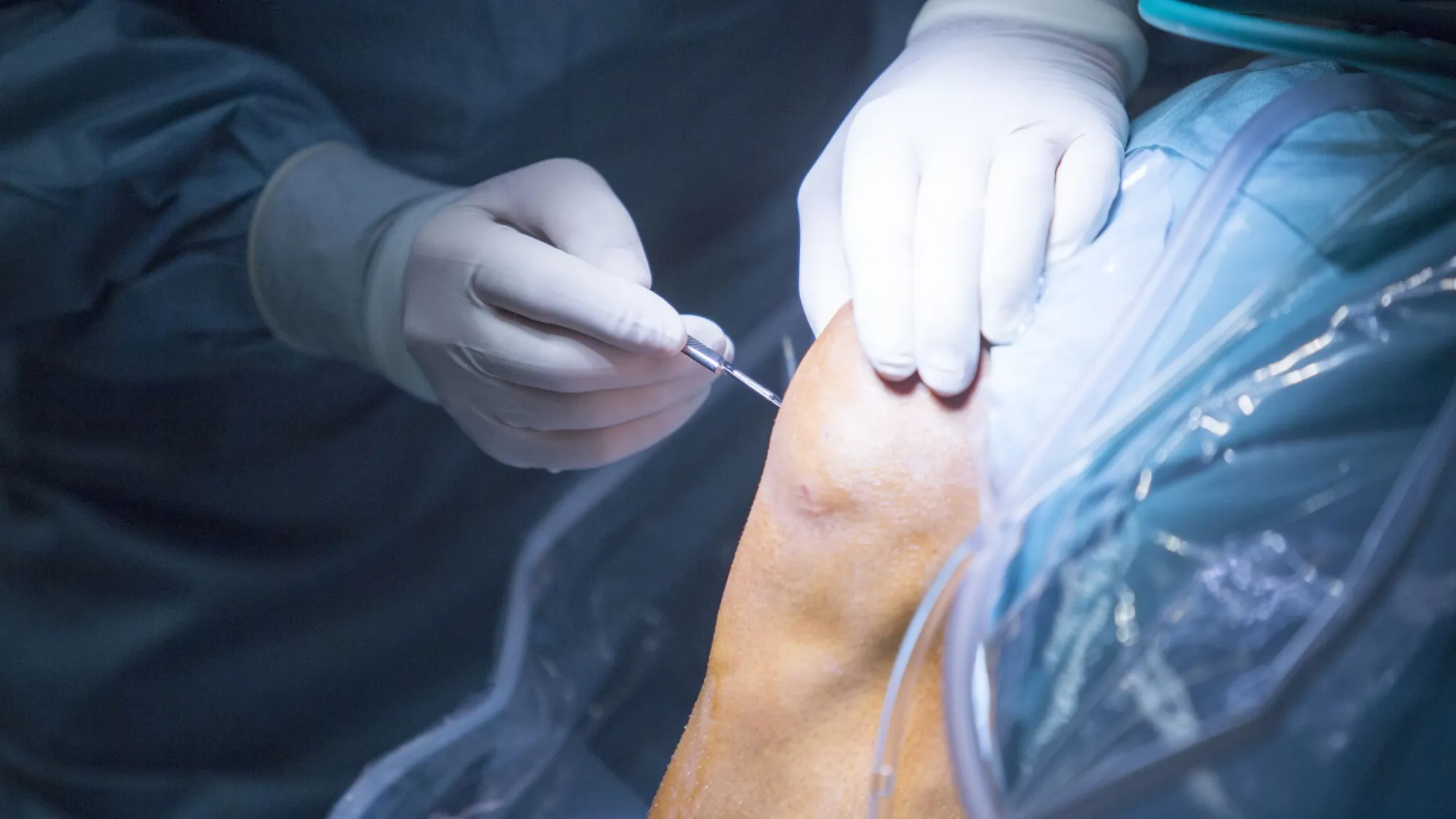 From Pain to Mobility: What to Look for When Choosing the Best Orthopedic Surgeon in Ahmedabad