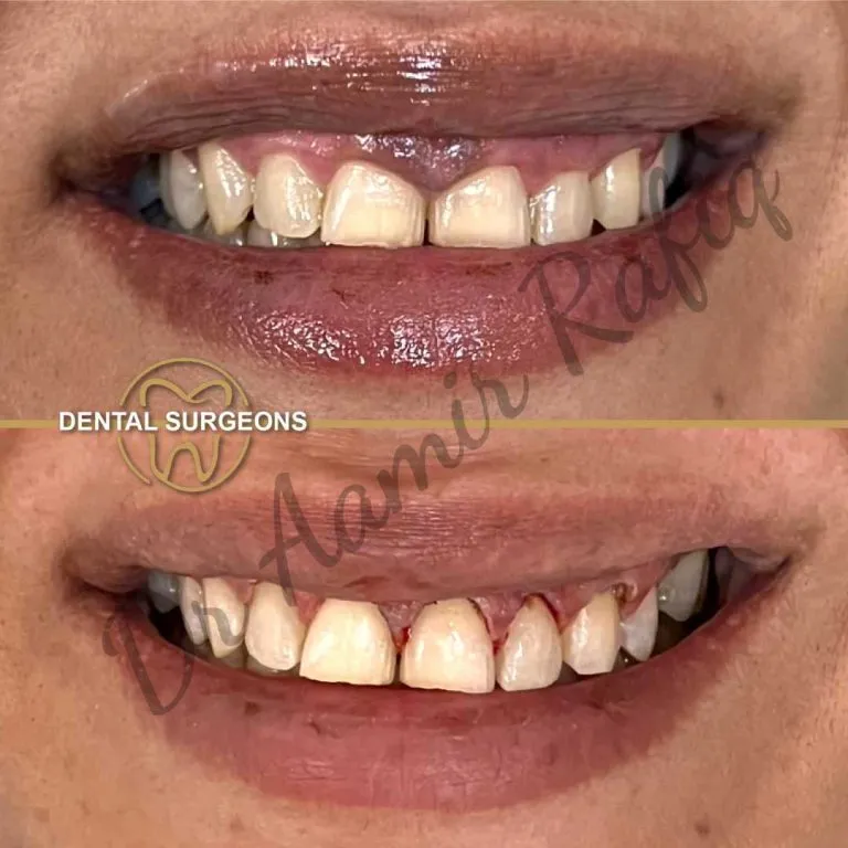 Your Morning Routine Might Be Missing One Important Dental Step | Preventive Dental Care