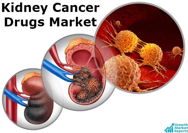 Kidney Cancer Drugs Market – Growth Market Reports
