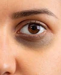 Radiant Eyes, Dubai Vibes: HydraFacial Cure