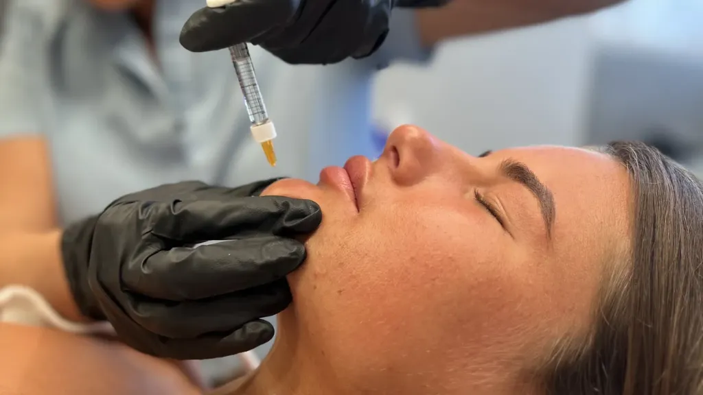 What Are Dermal Fillers? Types, Benefits, and the Full Treatment Process Explained
