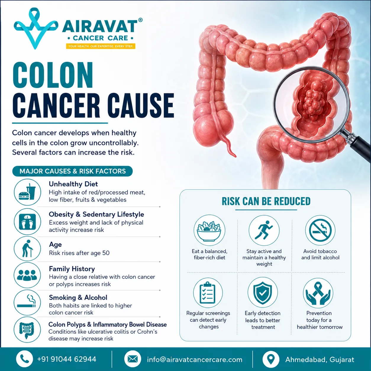 What Are the Most Common Risk Factors for Colon Cancer?