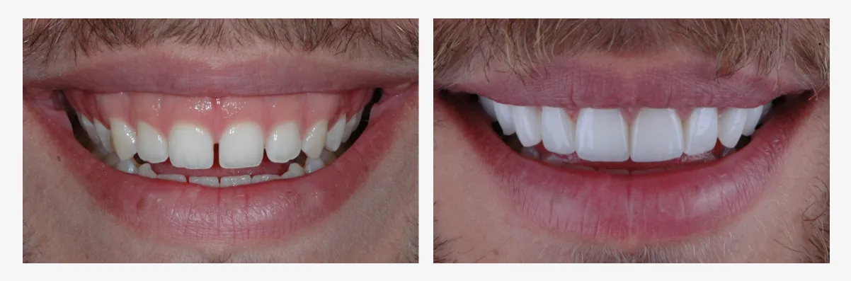 Modern Periodontal Care: Protecting Your Gums and Your Smile