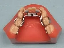 Choosing the Right Essix Retainer for Different Patient Needs