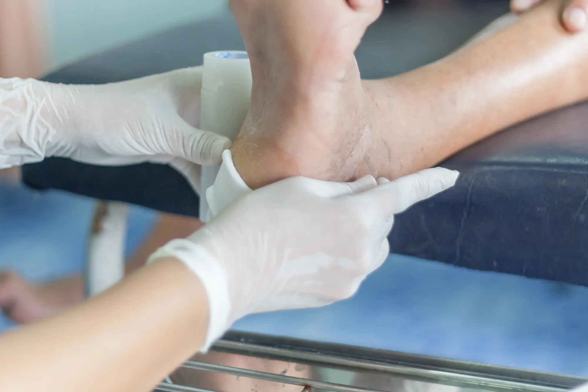 Diabetic Foot Wound Care: A Complete Guide to Healing