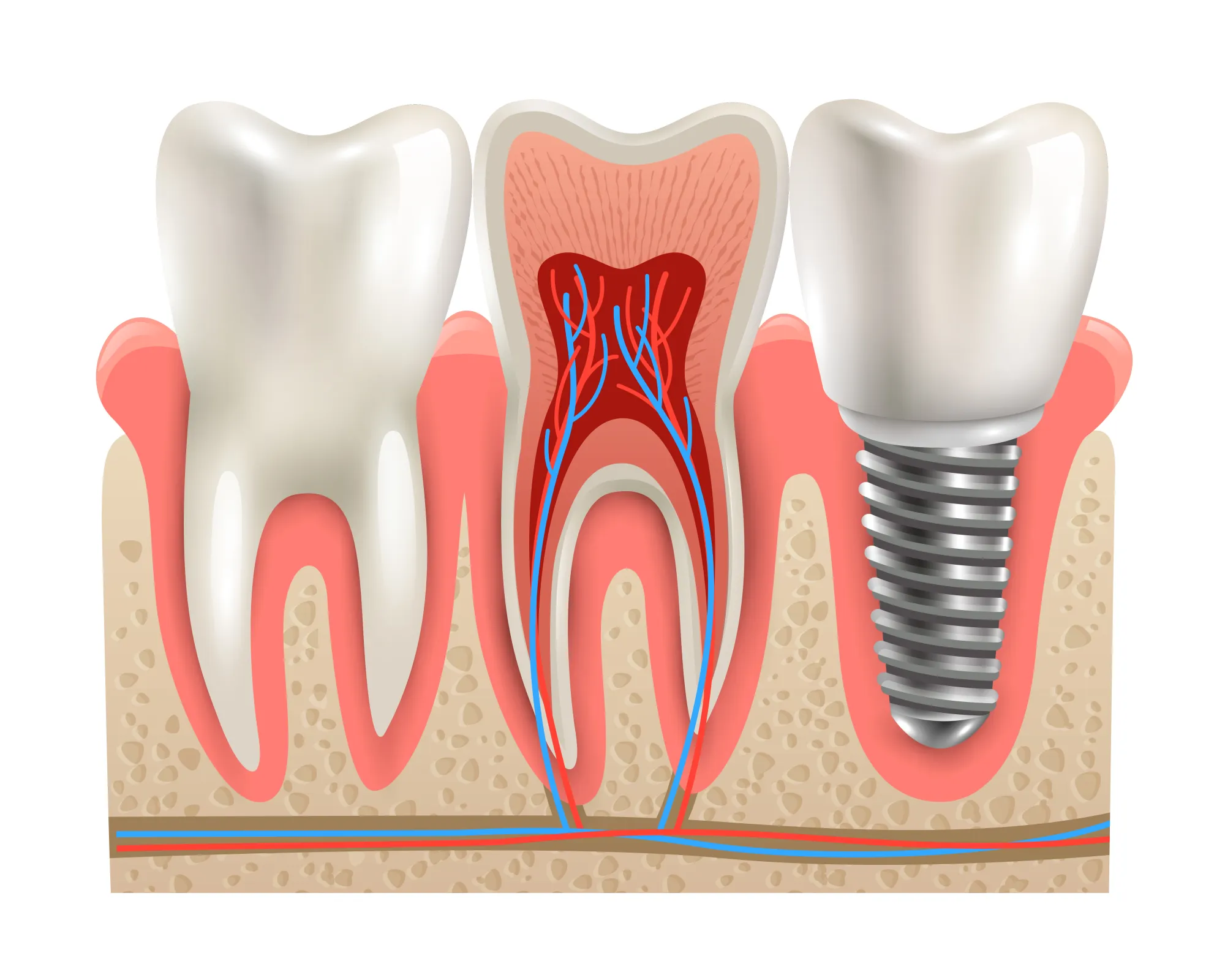 Root Canal Treatment: Everything You Need to Know
