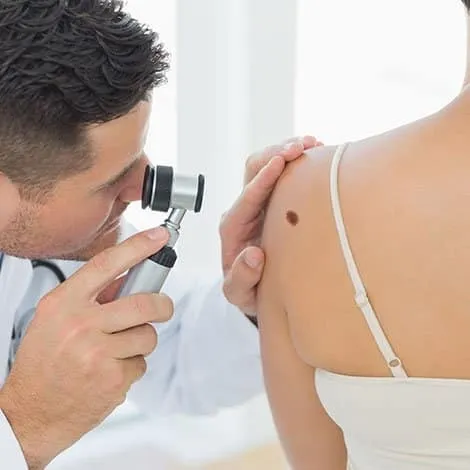 Beyond Visible Moles: What a Skin Cancer Clinic Can Assess