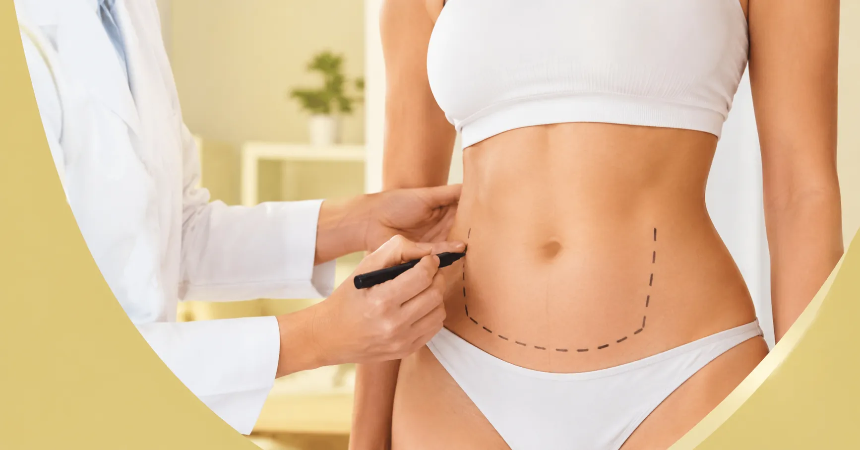 What Are the Risks and Side Effects of Tummy Lipo?