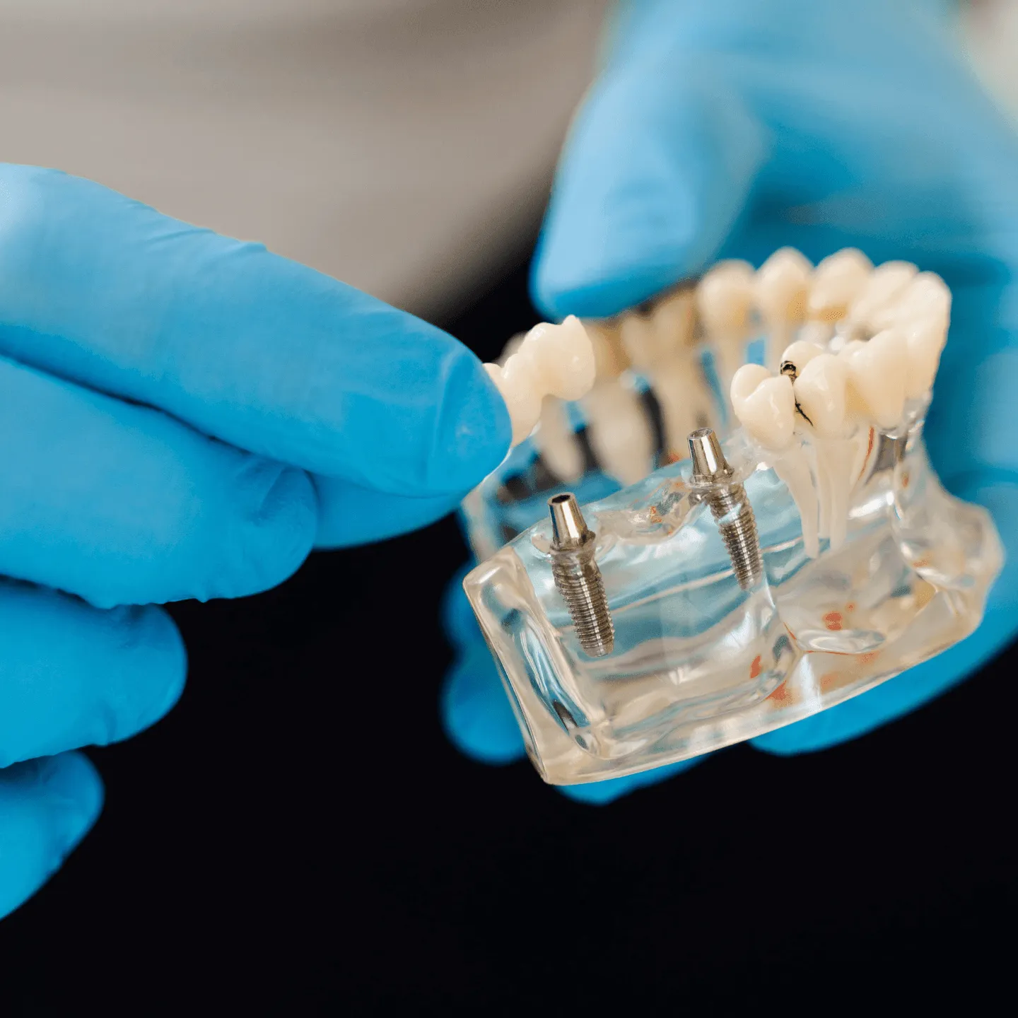 What to Look for in the Best Dentist in Temecula Before You Book