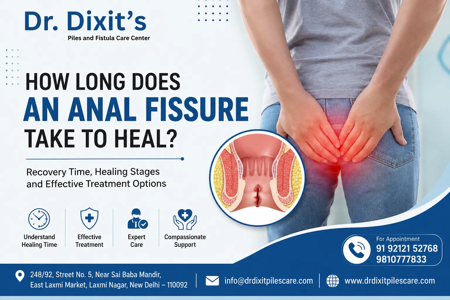 How Long Does an Anal Fissure Take to Heal? Understanding the Recovery Timeline