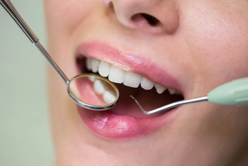 How Long Do Dental Composite Fillings Really Last?
