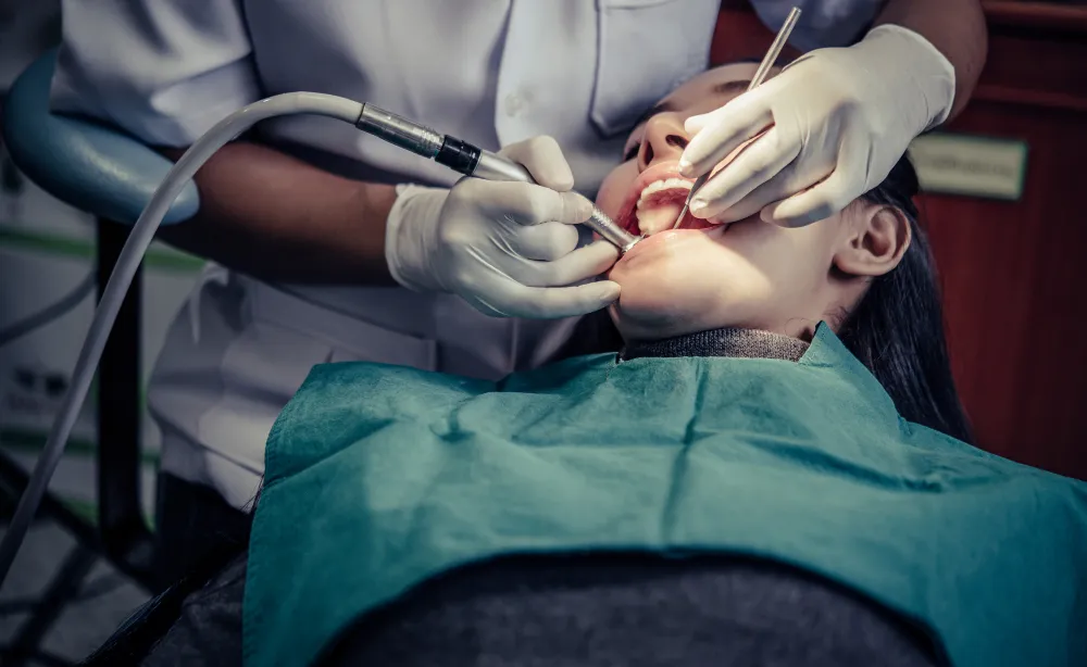 Dental Composite Fillings