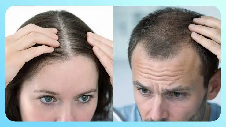 Natural Ways to Support Healthy Hair growth and Reduce Hair loss