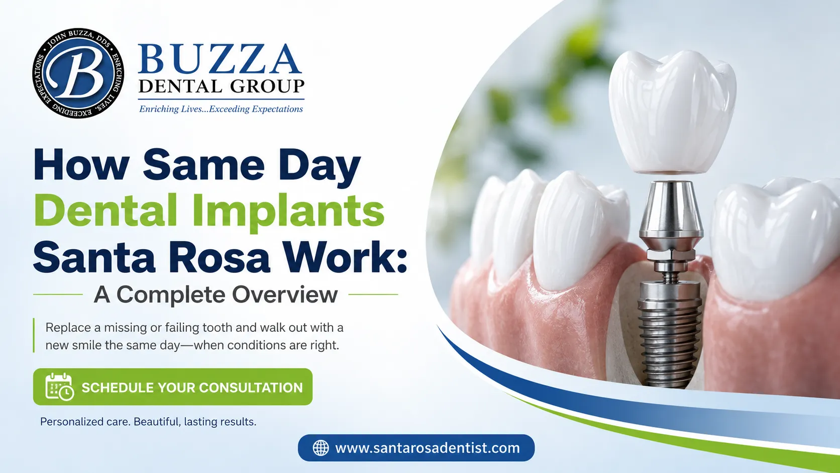 How Same Day Dental Implants Santa Rosa Work