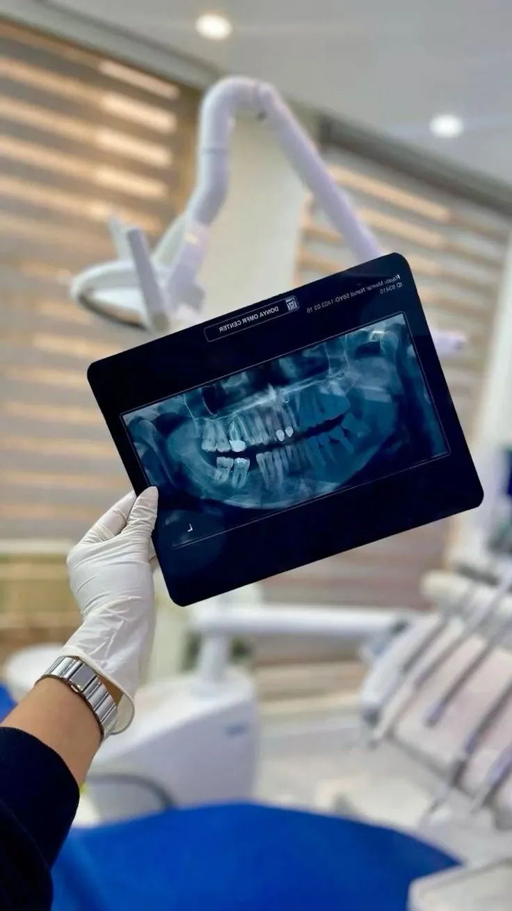 Why Dental X-Rays Are Important: Seeing What Your Dentist Can’t