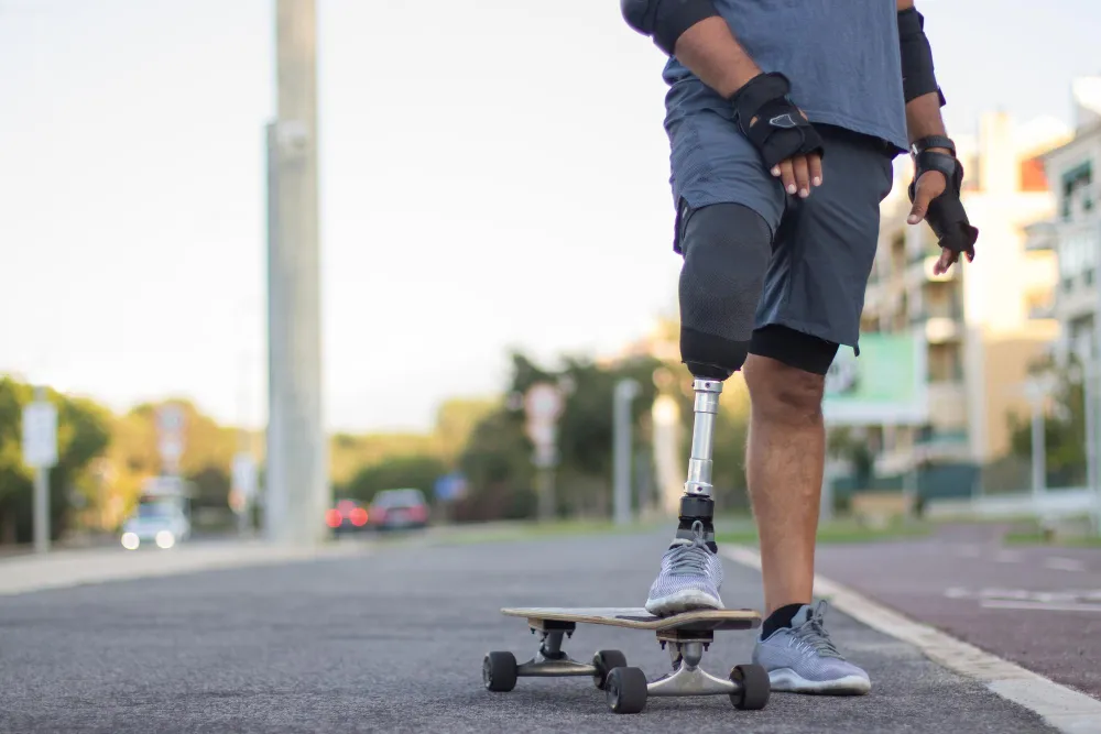 How Modern Prosthetic Leg Technology Can Support Gainesville Patients