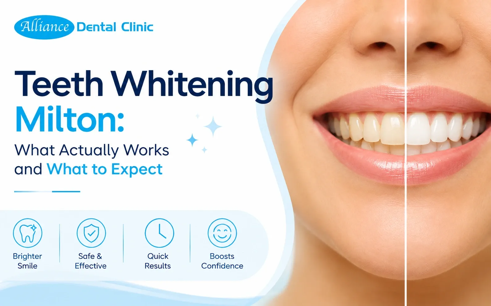Teeth Whitening Milton: What Actually Works and What to Expect