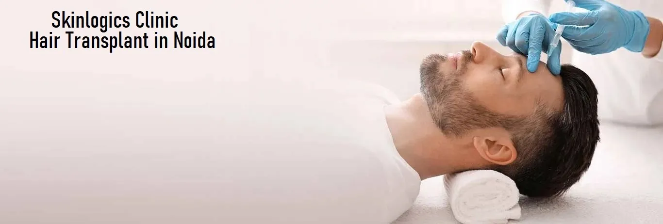 Why Your Donor Area Matters More Than Hair Loss in a Hair Transplant