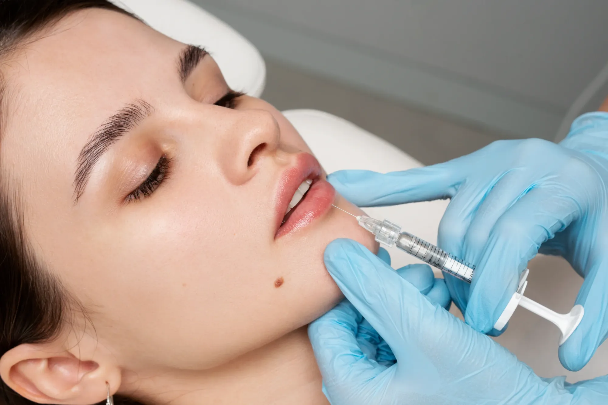 What Benefits Can Choosing Dermal Fillers in Nagpur Offer for Facial Rejuvenation?