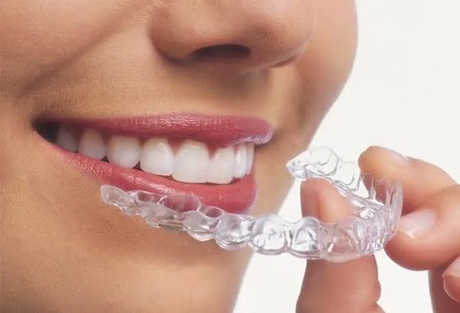 Invisalign in Dubai for Discreet Smile Correction