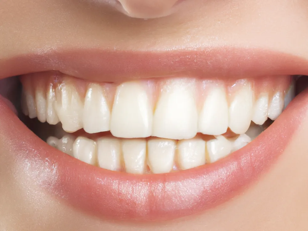 Dental Gold Dilemmas: Yes, You Can Actually Sell Your Old Gold Crowns