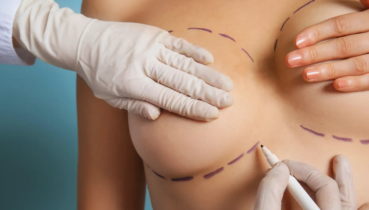 Beyond Enhancement: The Art and Science of Breast Augmentation