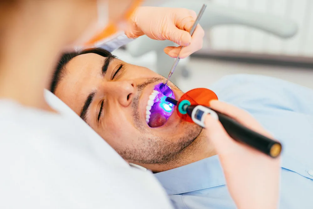 Finding a Family Dentist Near Me Offering Sealants for Cavity Prevention