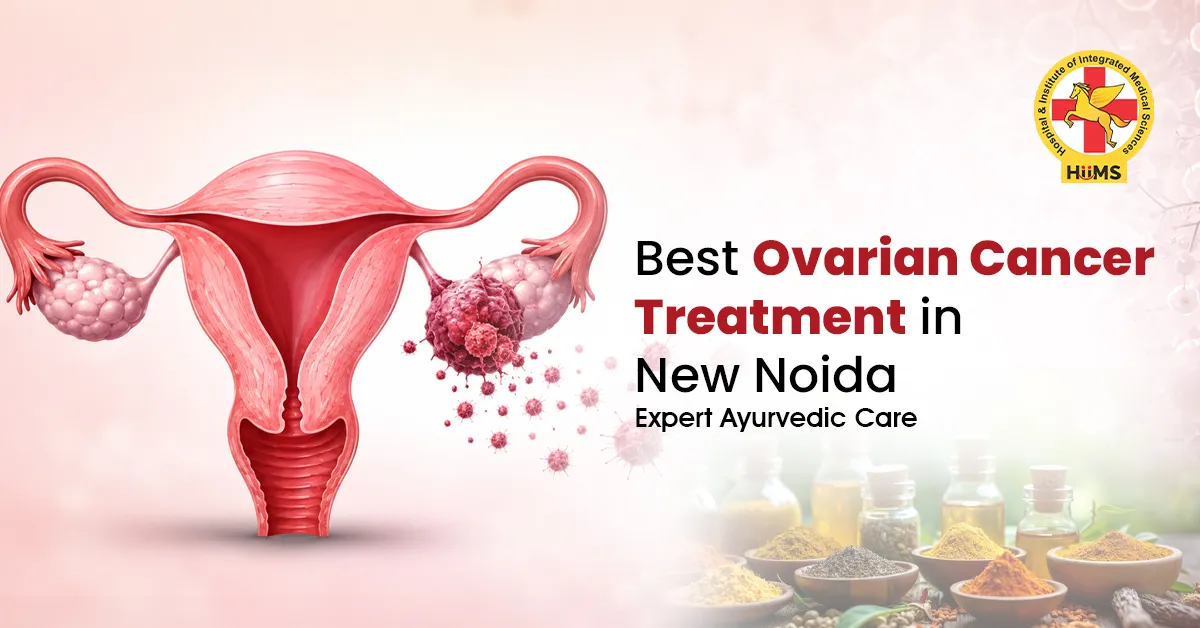 Best Ovarian Cancer Treatment in New Noida: Understanding Care Options