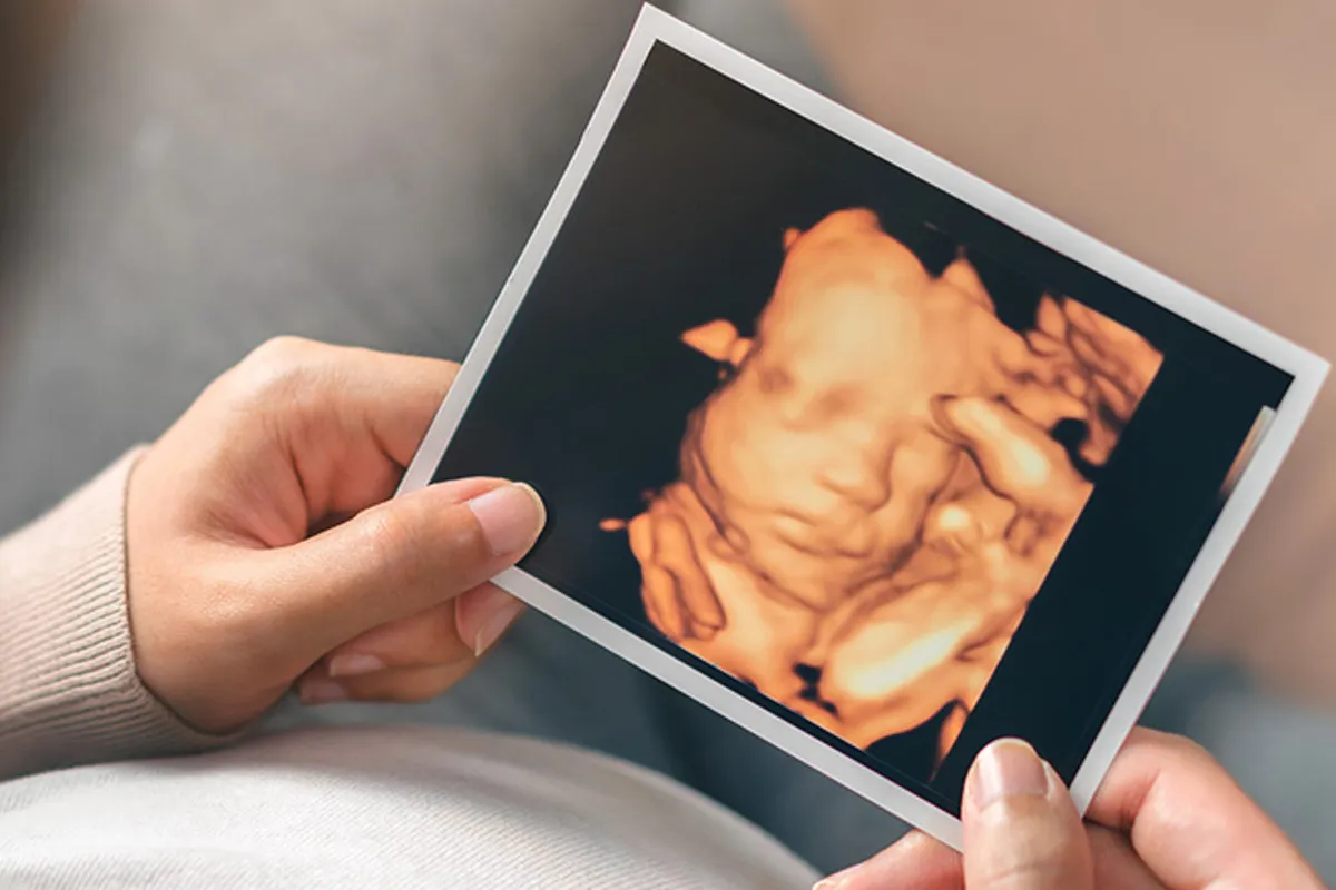 Experience the Beautiful Journey of Motherhood With Early Gender Ultrasound