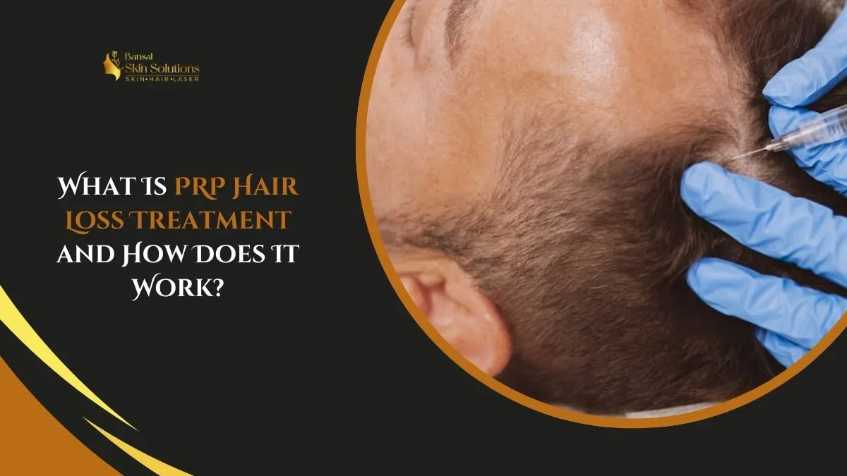 What Is PRP Hair Loss Treatment and How Does It Work?