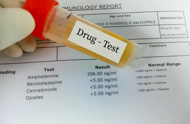 Which Substances Are Commonly Checked During Drug Screening?