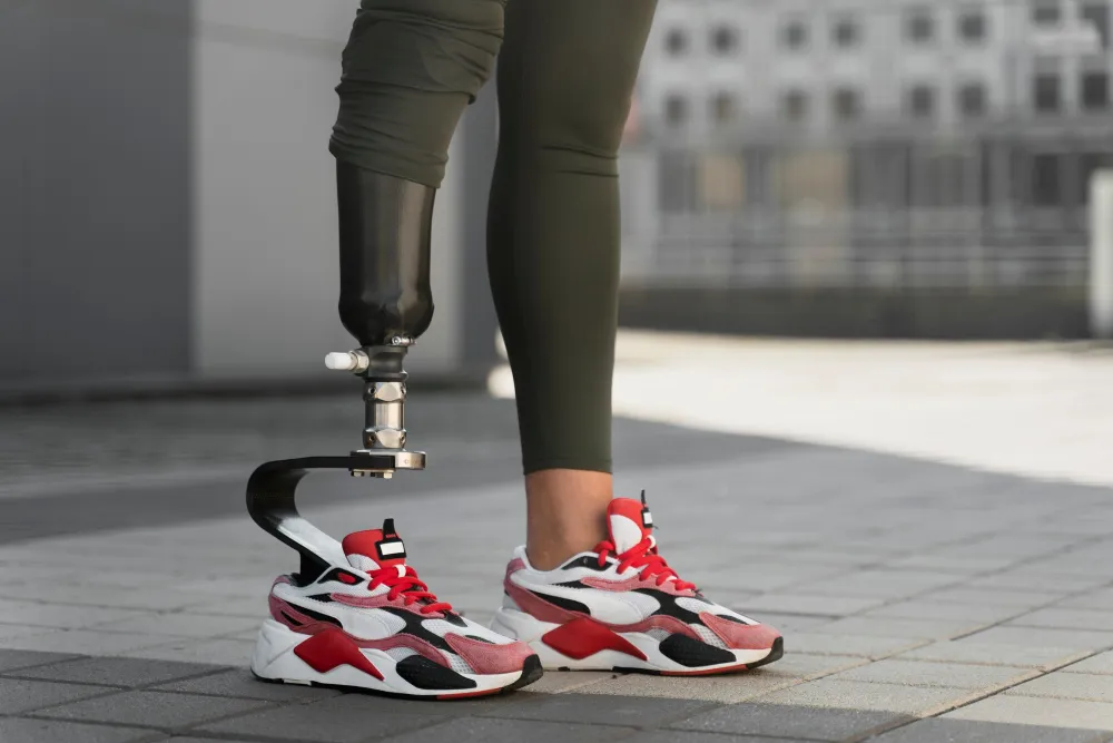 Exploring Personalized Prosthetic Limb Services for Different Needs