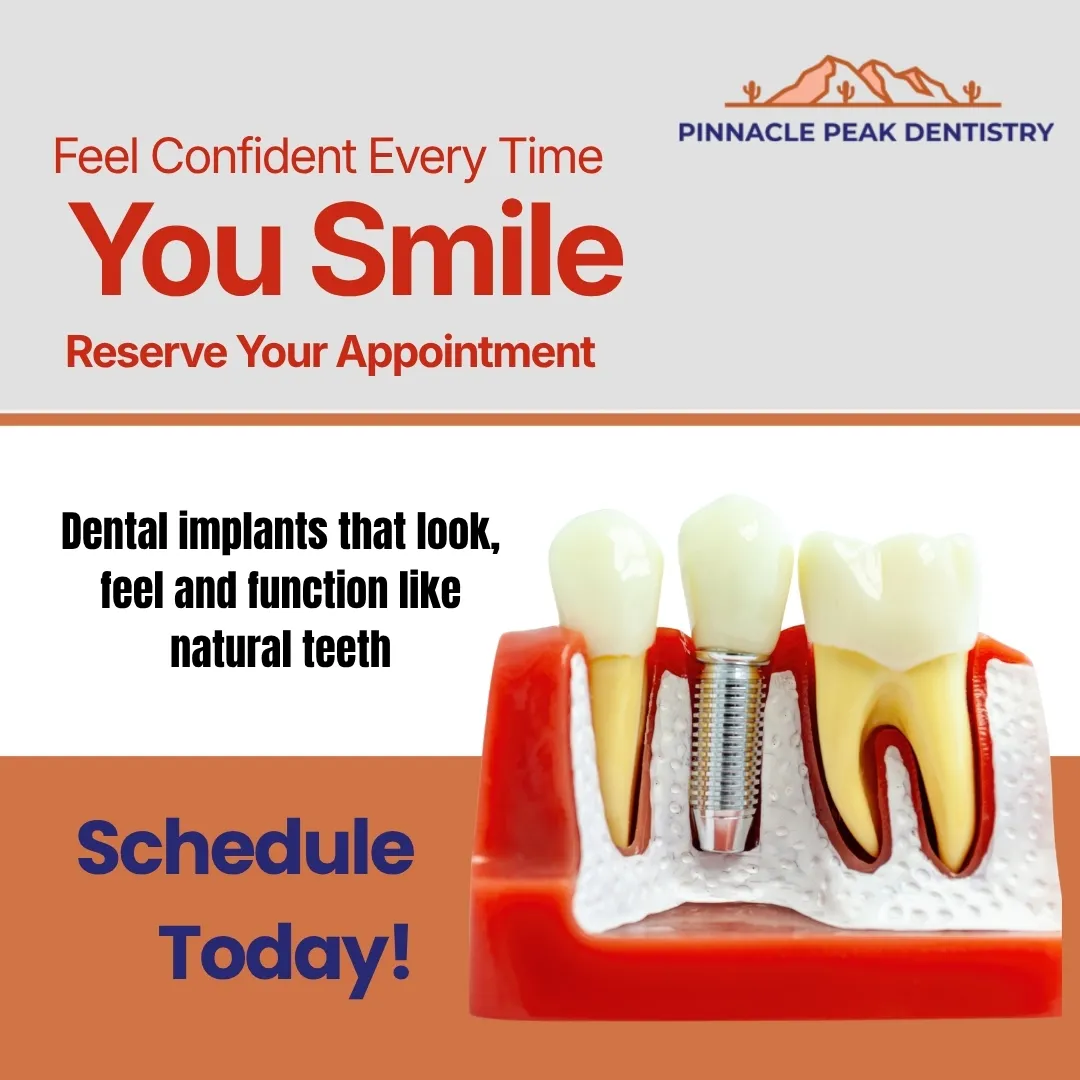 What Patients Should Know Before Getting Dental Implants in Scottsdale