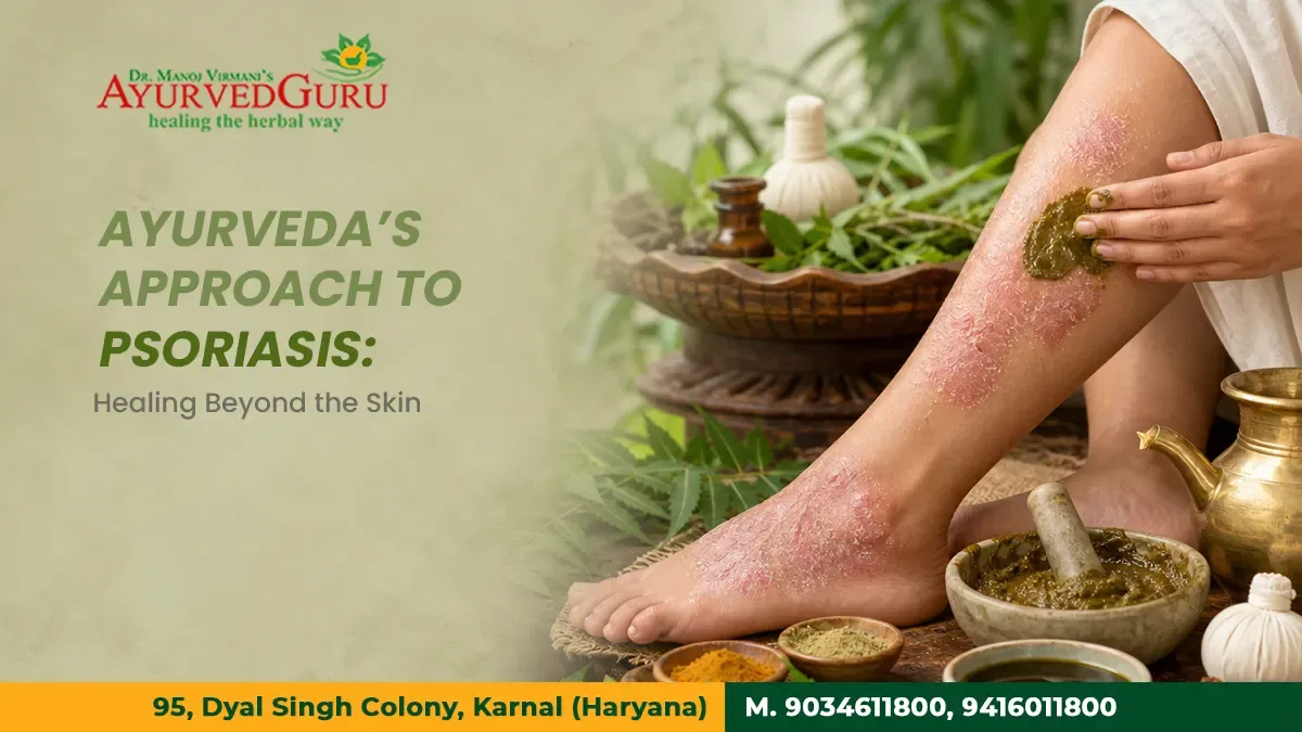 Ayurveda’s Approach to Psoriasis: Healing Beyond the Skin