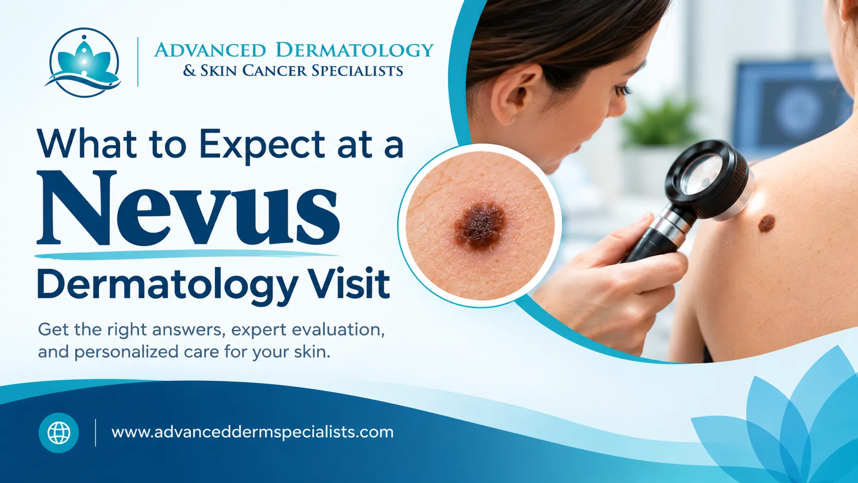 What to Expect at a Nevus Dermatology Visit
