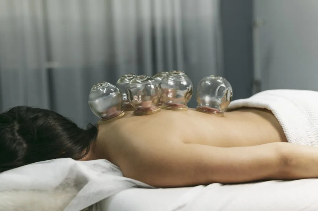 acupuncture near me