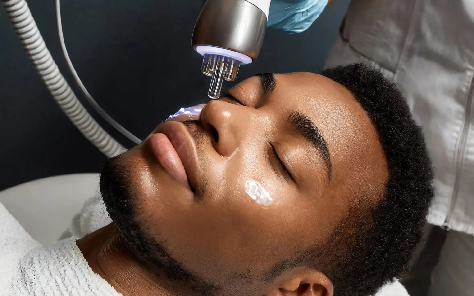 Why More Men in Tysons Are Choosing Laser Treatments for Grooming and Skin Care