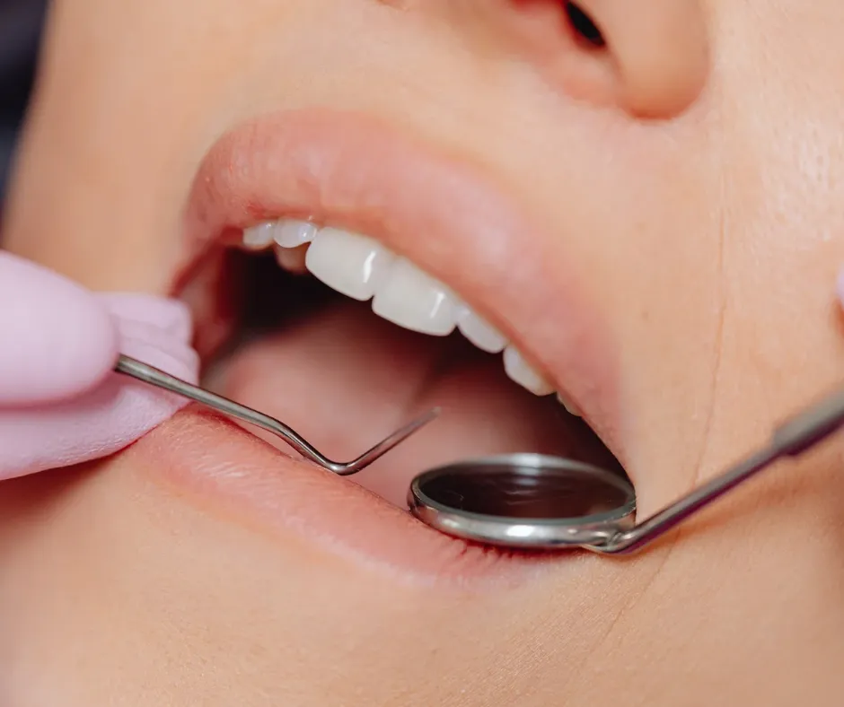 Dental Implants vs Implant Supported Dentures: Which Is Right for You?