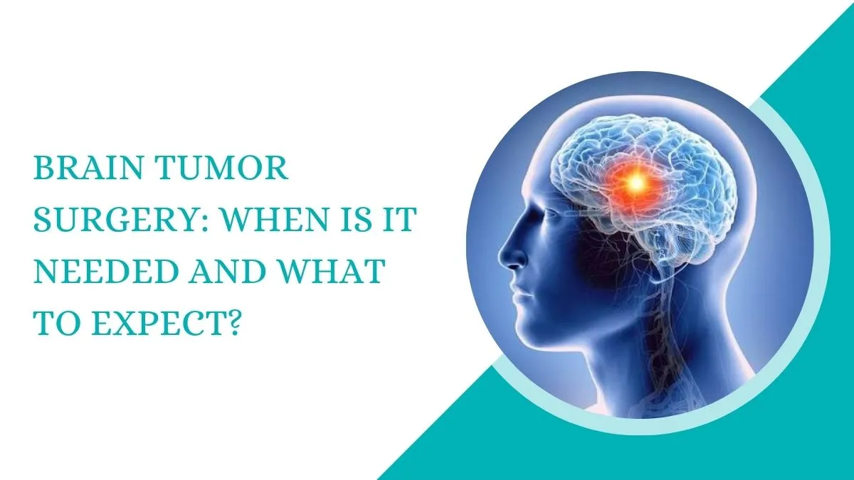 Brain Tumor Surgery: When Is It Needed and What to Expect?