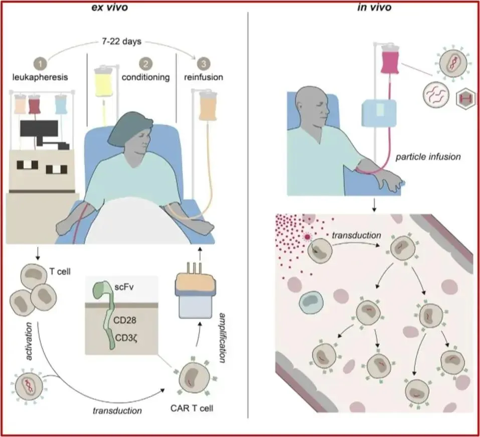 Lentiviral In Vivo CAR-T: Achieving Dual Breakthroughs in Transduction Efficiency and Safety