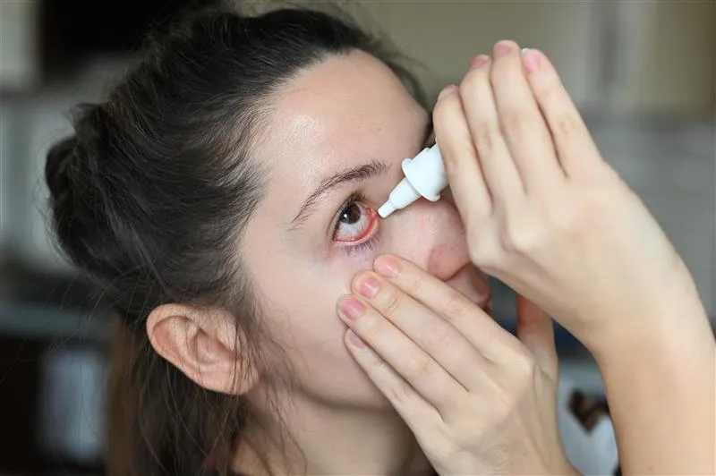What Your Bloodshot Eyes Could Be Telling You