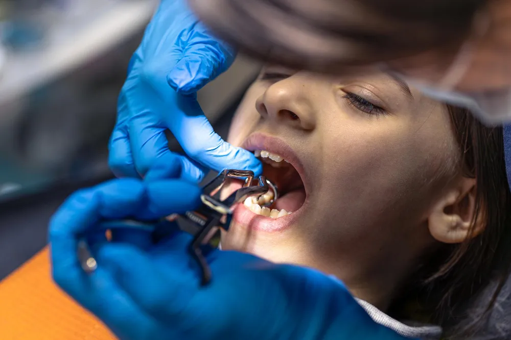 How to Choose the Right Kids Dental Clinic for Your Child