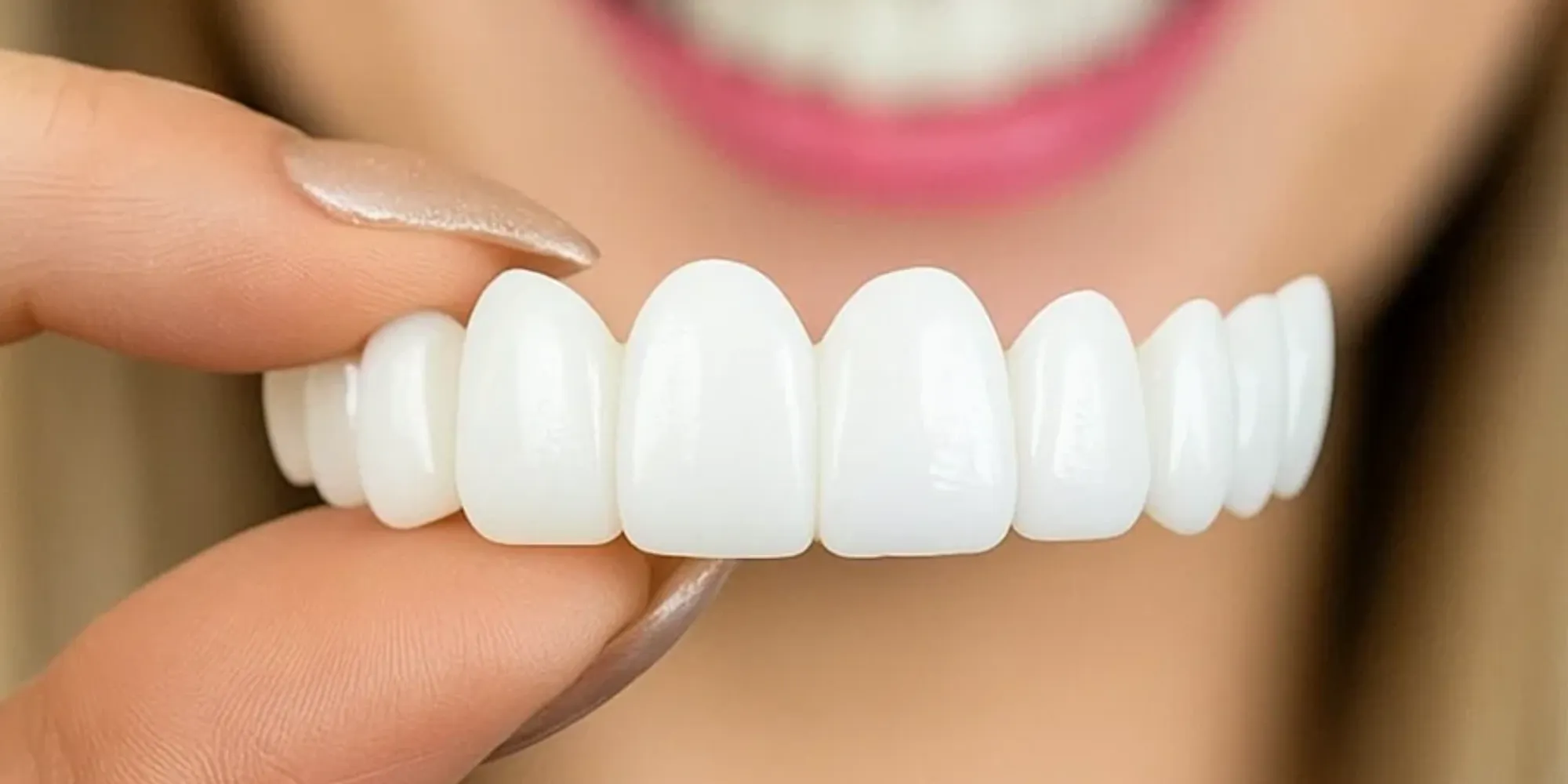 Porcelain Veneers Ventura CA: A Guide to a More Confident Smile