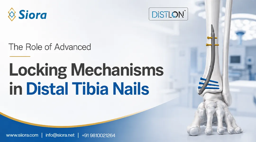 The Role of Advanced Locking Mechanisms in Distal Tibia Nails