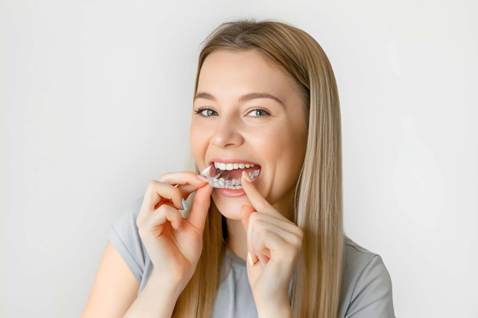 How Affordable Braces Near Me Can Support Accessible Orthodontic Care