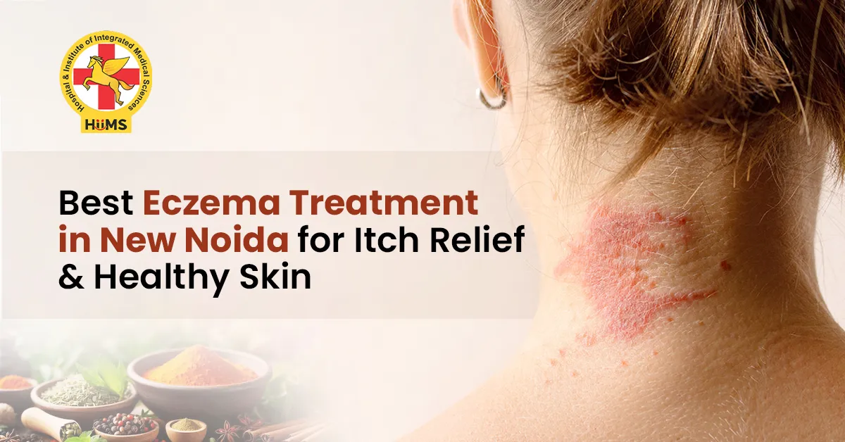 Best Eczema Treatment in New Noida: Early Signs and Skin Care Tips