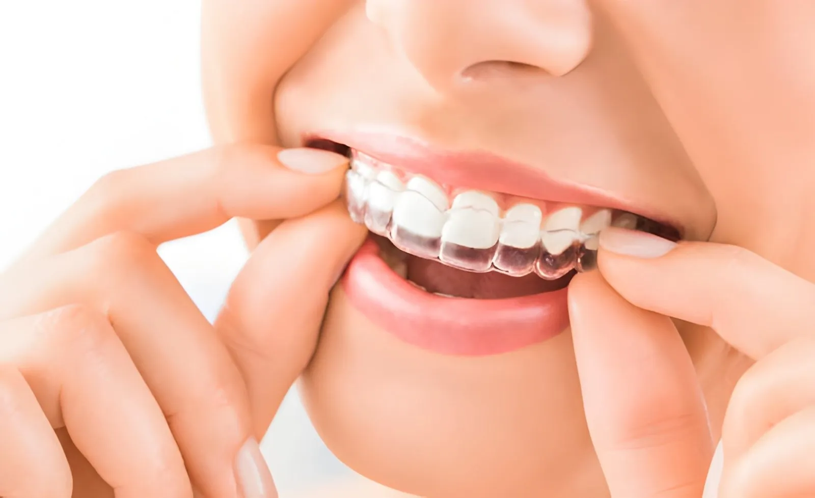 How Night Guards Can Help Protect Teeth and Support Better Oral Health