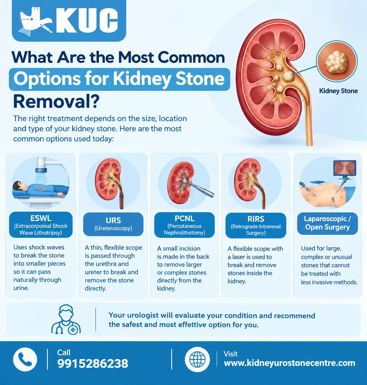 What Are the Most Common Options for Kidney Stone Removal?
