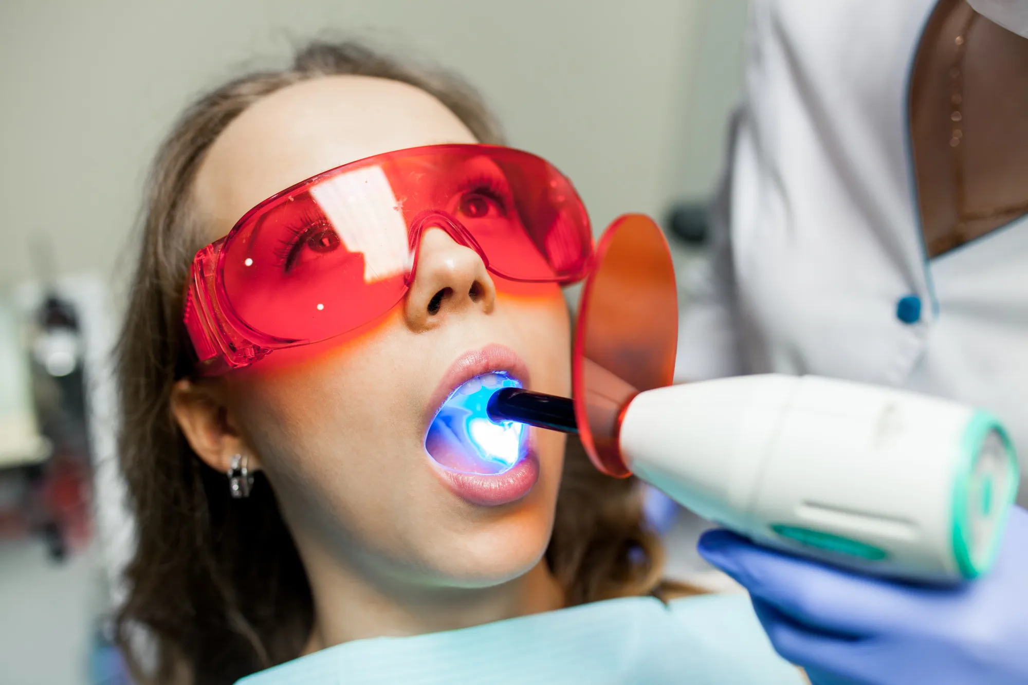 Benefits of Dental Sealants Near Me