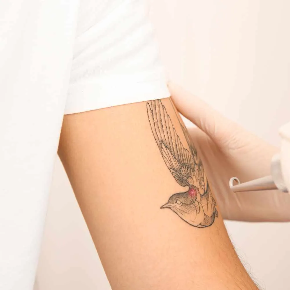 What Actually Determines If a Tattoo Fully Clears